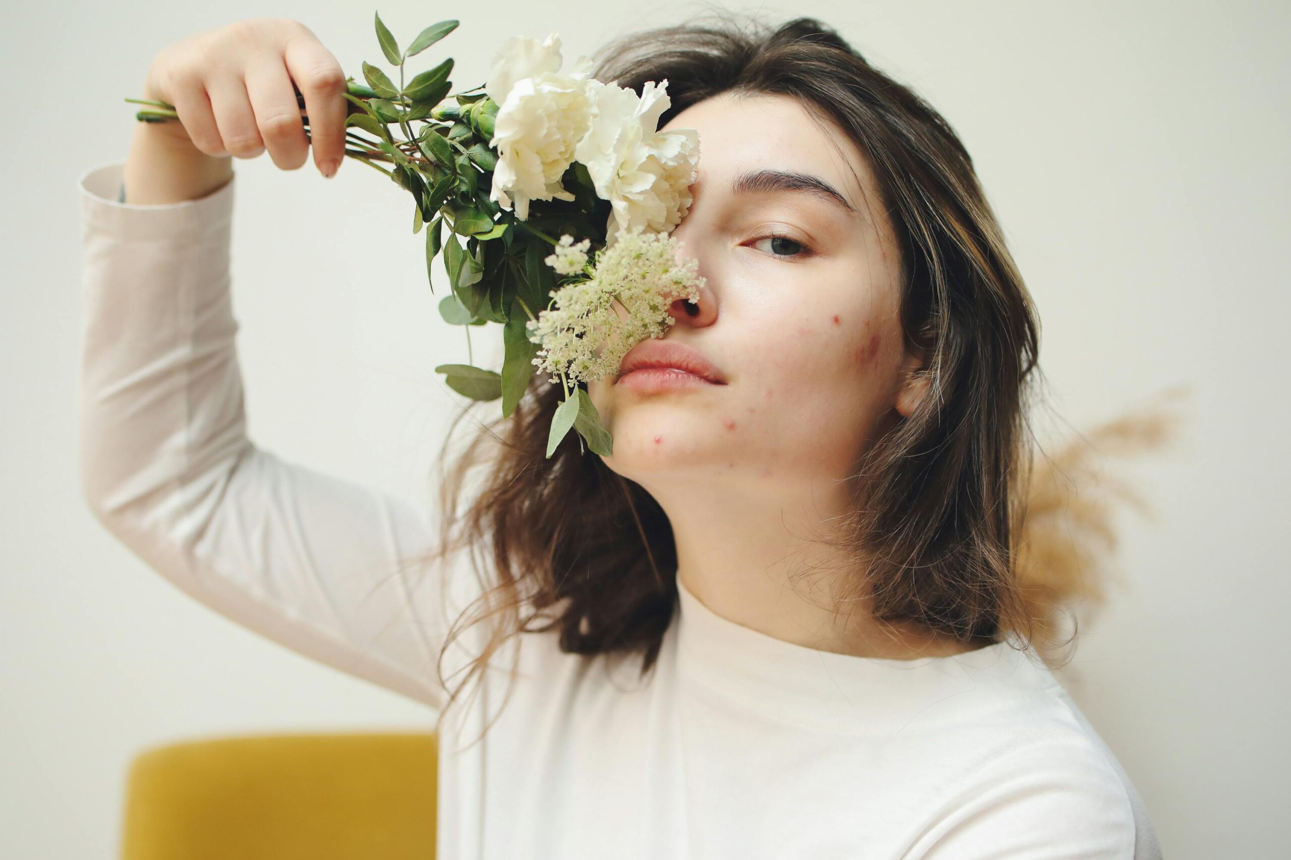 Portrait of a young woman embracing natural beauty, holding white flowers and showing acne.