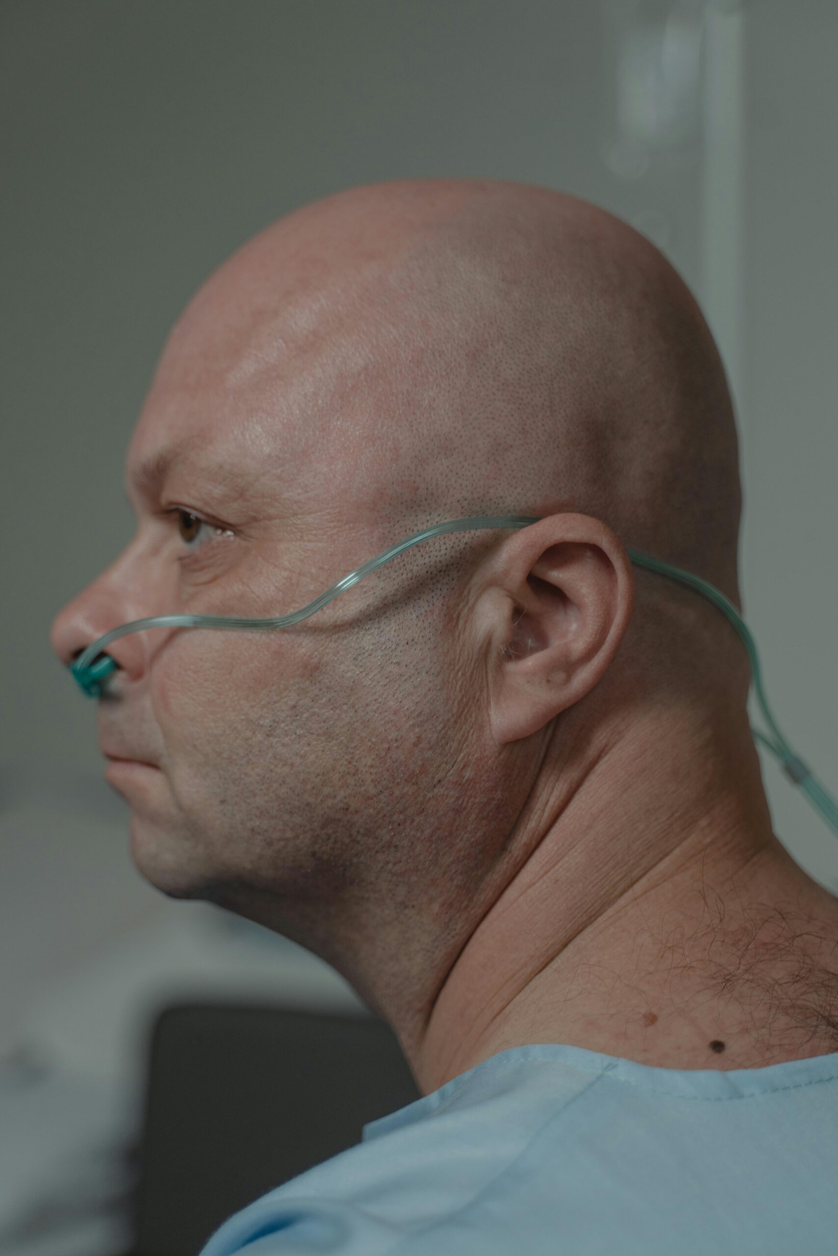 A side view of a bald male patient wearing a nasal cannula in a hospital setting.