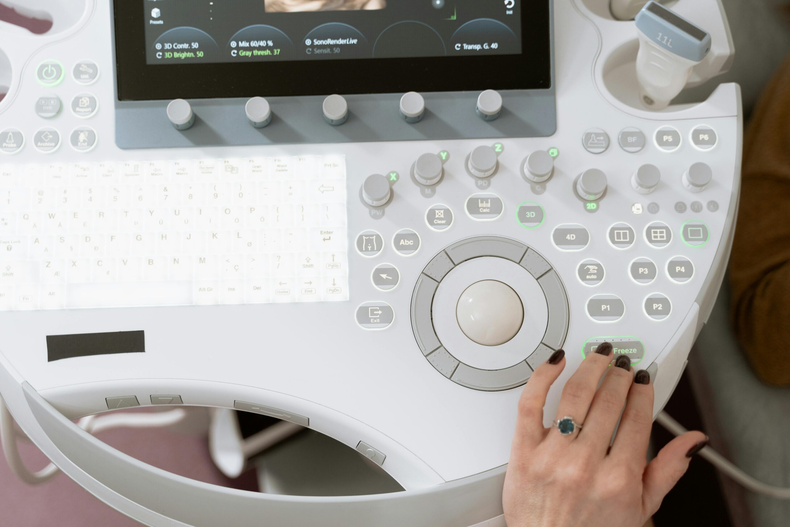 Close-up of a medical professional operating modern ultrasound equipment for diagnosis