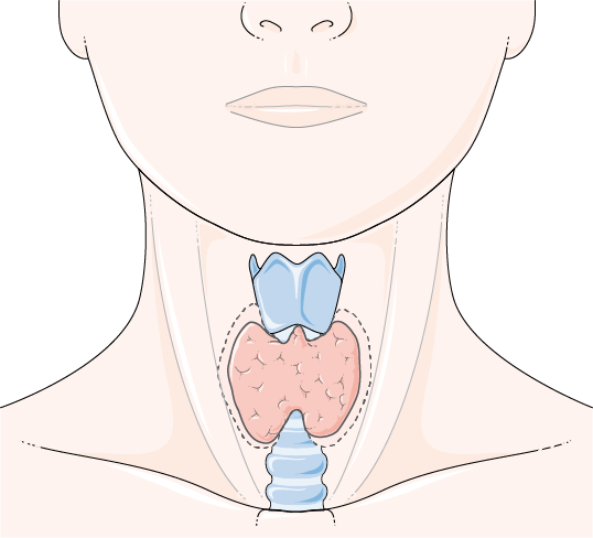 Hypothyroidism and Finger Joint Pain