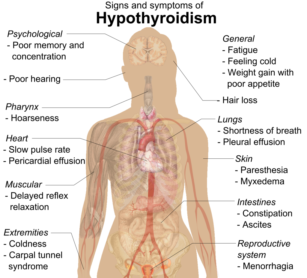 hypothyroidism pimples