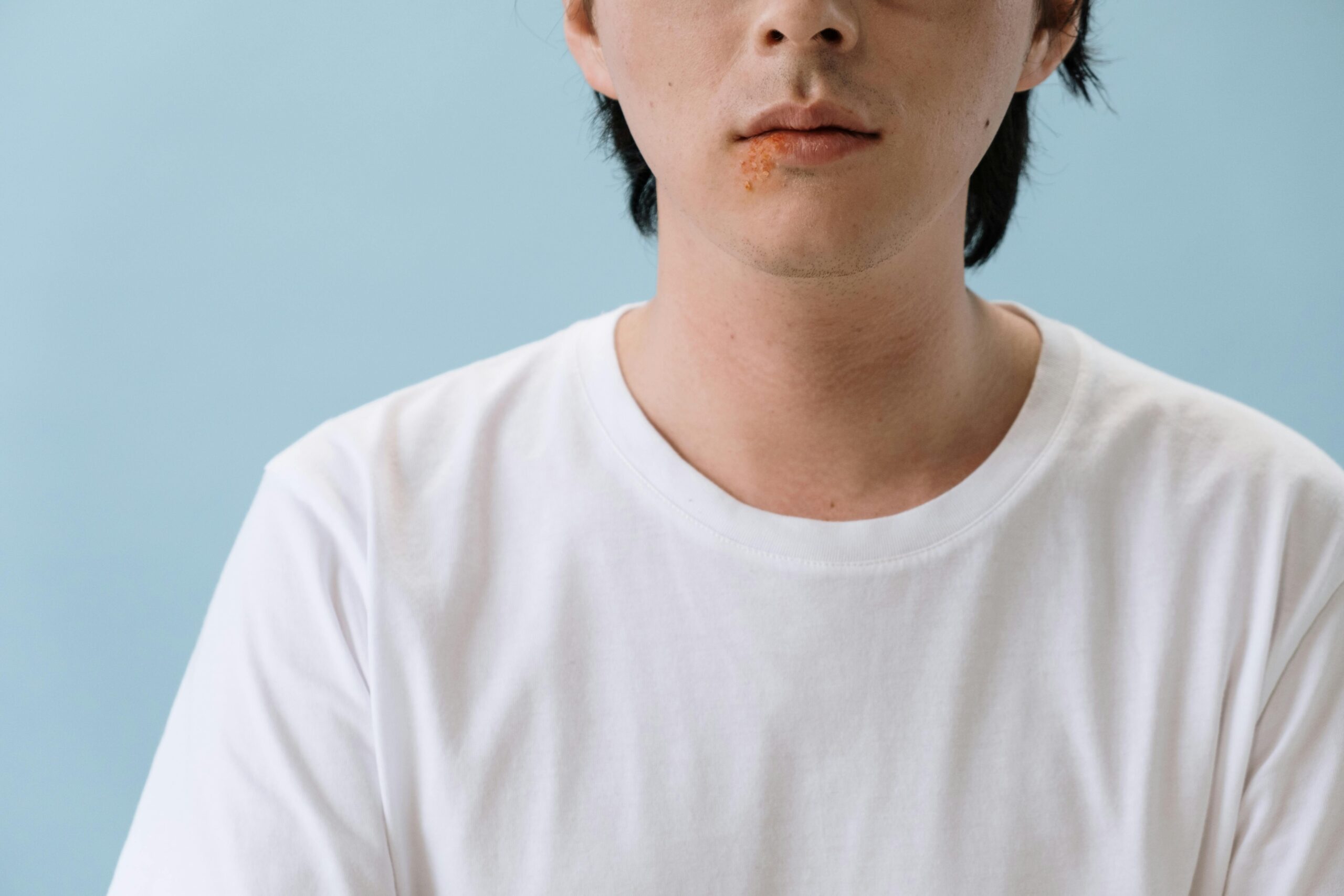 Close-up image of an adult male with a facial skin condition against a blue background.