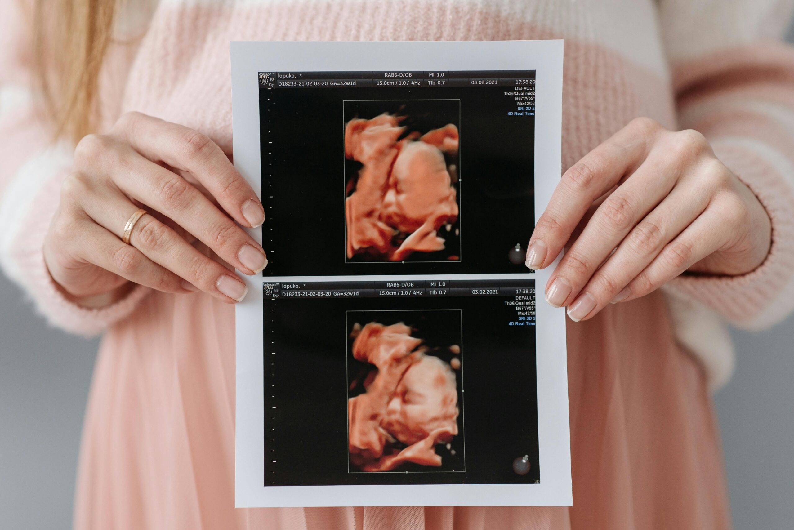 Close-up of a pregnant woman holding an ultrasound printout, symbolizing anticipation and maternity care.