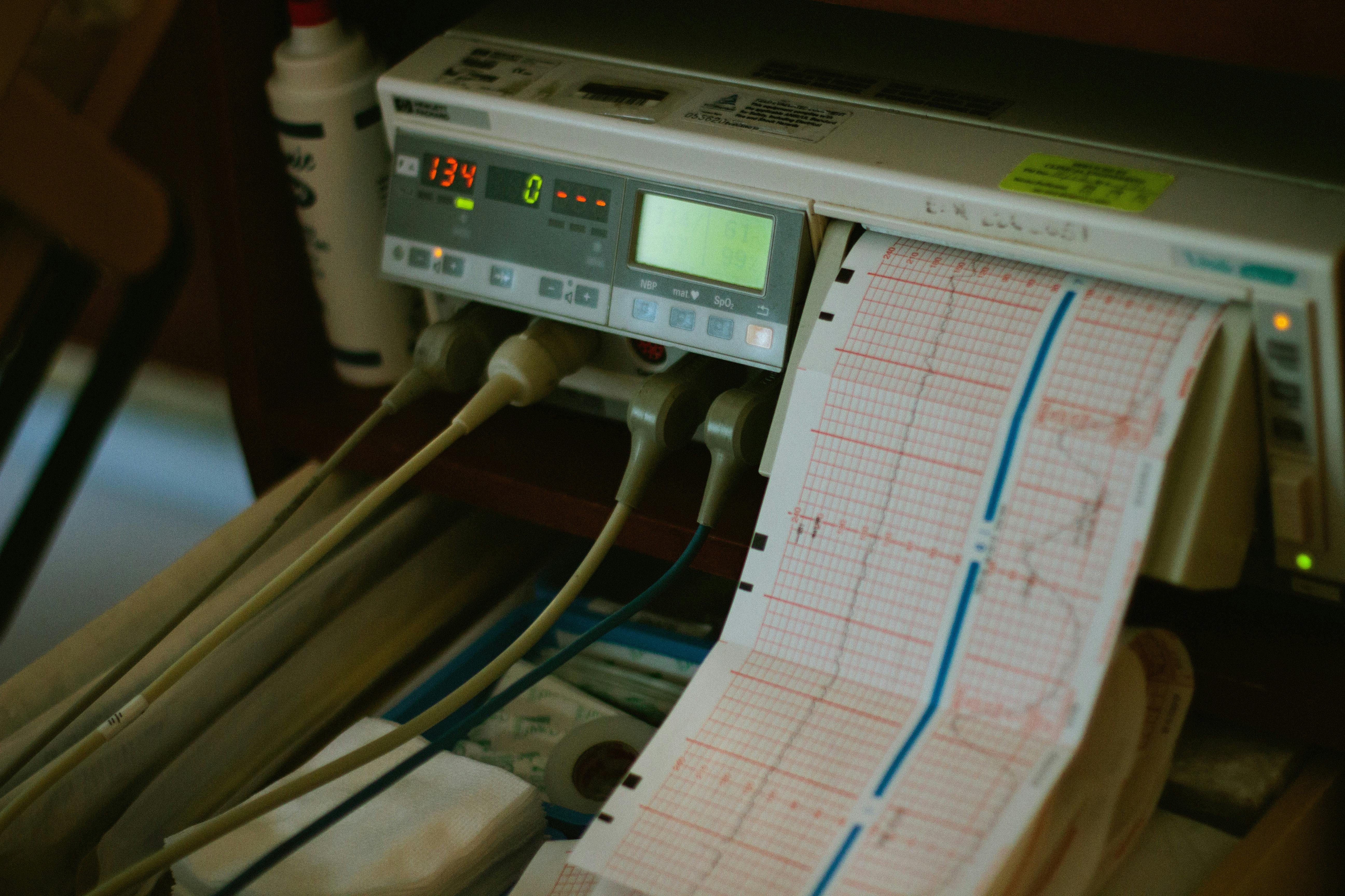 Close-up of an ECG machine displaying heart rate results in a hospital setting.